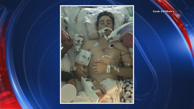 North Texas teen's lung failure linked to vaping
