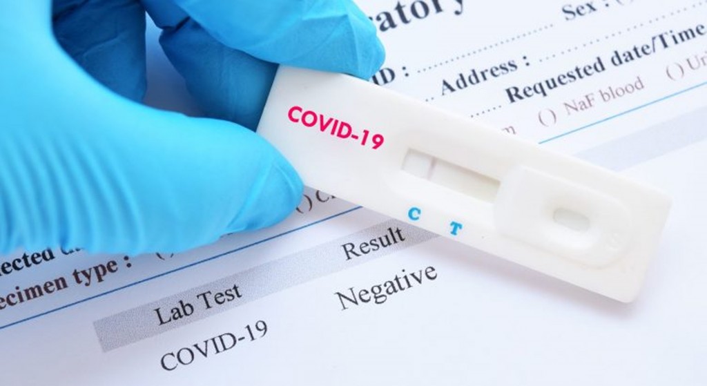 80% of coronavirus test kits 'gifted' to Czechs by China faulty