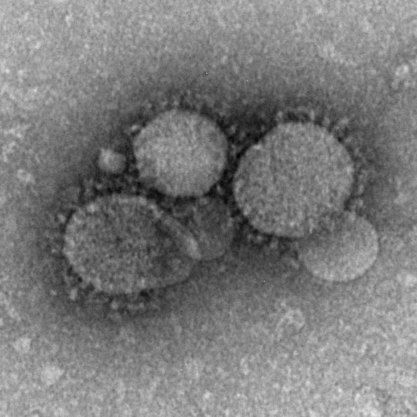 Researchers combine MERS and rabies viruses to create innovative 2-for-1 vaccine