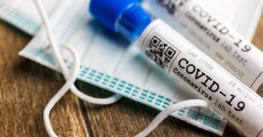 CoVID-19 Testing PCR – A Critical Appraisal