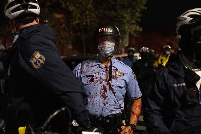 Philly City Council Strips Cops Of Rubber Bullets, Tear Gas After Dozens Wounded In Street Violence