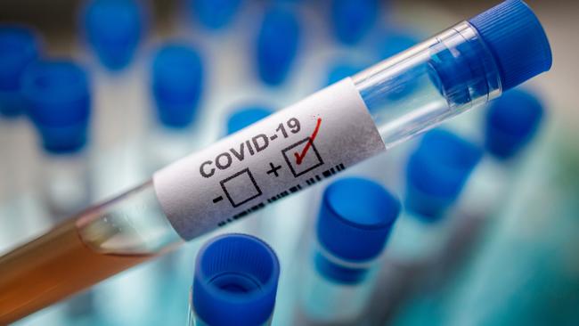 Tested 'Positive' For COVID-19? Be Sure To Ask This Question
