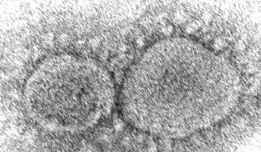 Virus experts demand new probe into origins of COVID-19