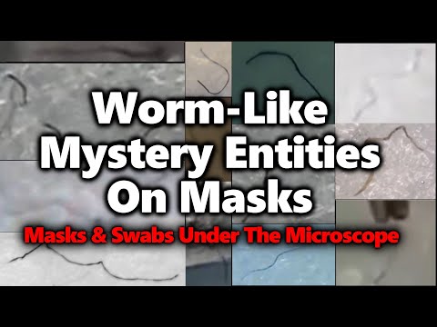 Can diatomaceous earth get rid of COVID swab squigglies | Morgellons?