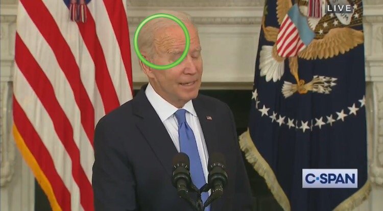 Observers Notice Bizarre Spot on the Side of Biden’s Head as He Goes Blank For 8 Seconds Straight During Presser (VIDEO)