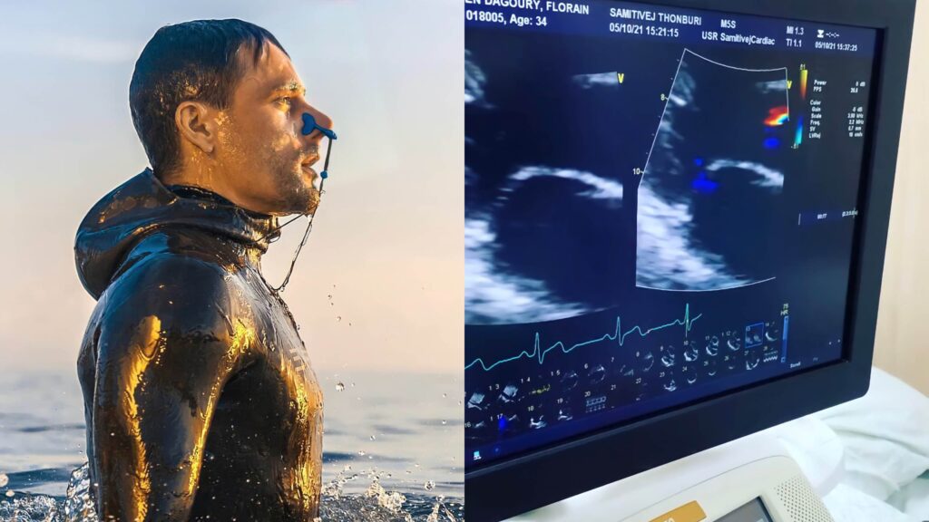 Florian Dagoury, the World’s Top Static Freediver, Is Diagnosed with Myocarditis After Taking Pfizer Vax – May End His Career
