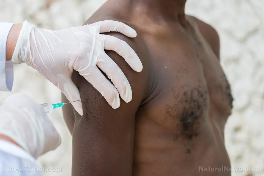 Africa is only 6% vaccinated, and covid has practically disappeared... scientists "baffled"
