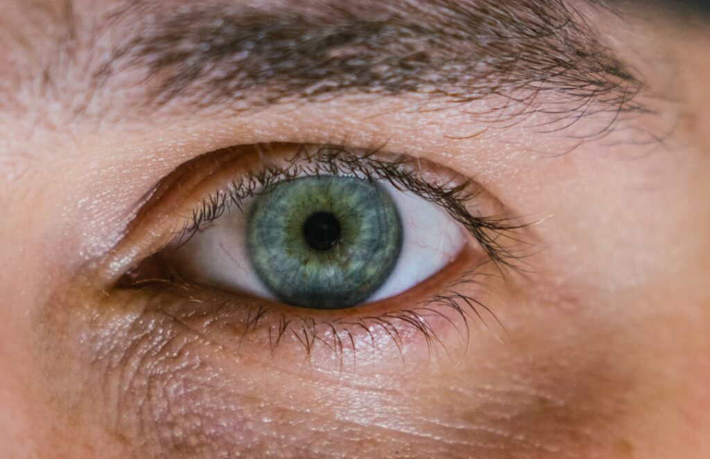 Hidden No Longer, Eyes Reveal Rare Mental Condition