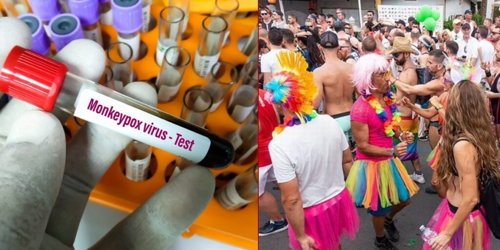 Monkeypox Outbreak Leads to First Mandatory Quarantine in Country That Hosted Massive Gay Pride Festival