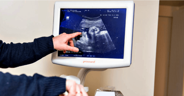 Exclusive — Brittany Hughes: CCDH and Democrats Trying to Censor Pregnancy Center Websites