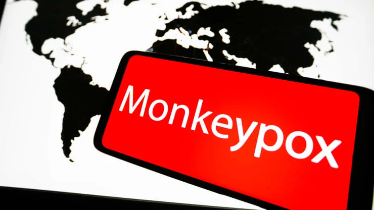 Here We Go: WHO Declares Monkeypox Outbreak a Global Health Emergency