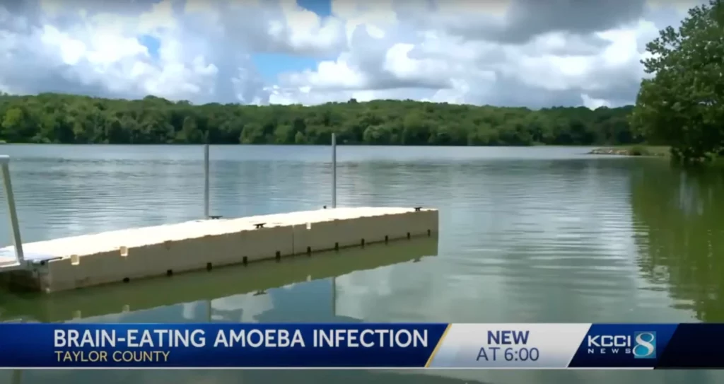 Infection Caused by a Rare ‘Brain-Eating Amoeba’ Seen for the First Time in 35 Years in Missouri
