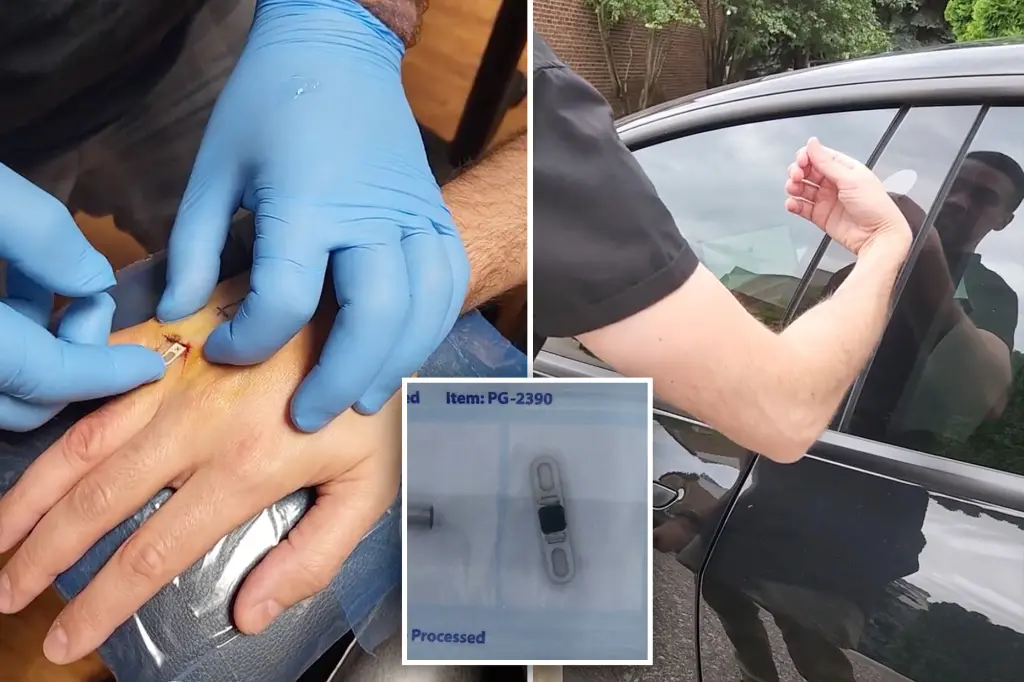 Tesla owner will never lose his keys again — after he implants them in his hand
