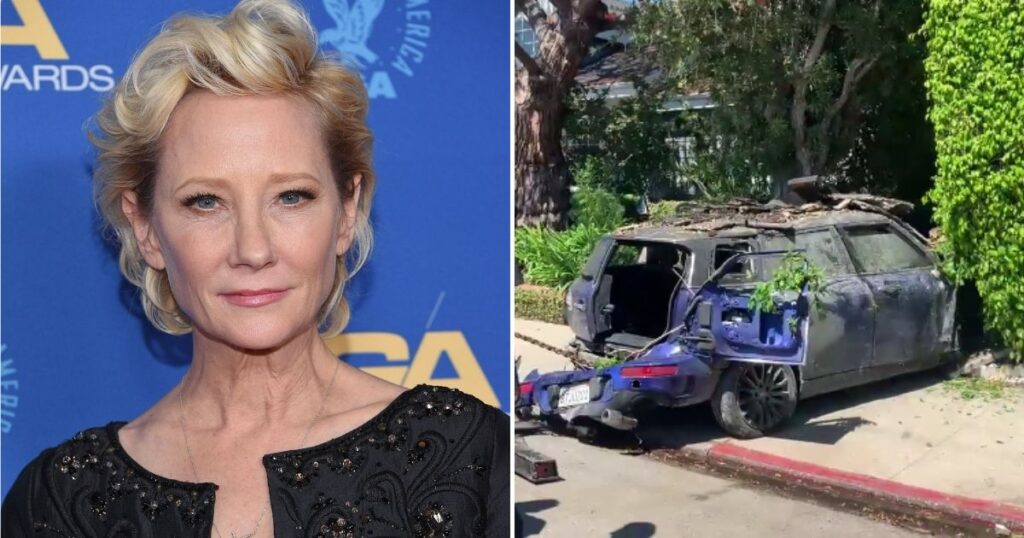 Actress Anne Heche Presumed to Be Under the Influence During Fiery Wreck, But She Will Not Be Tested