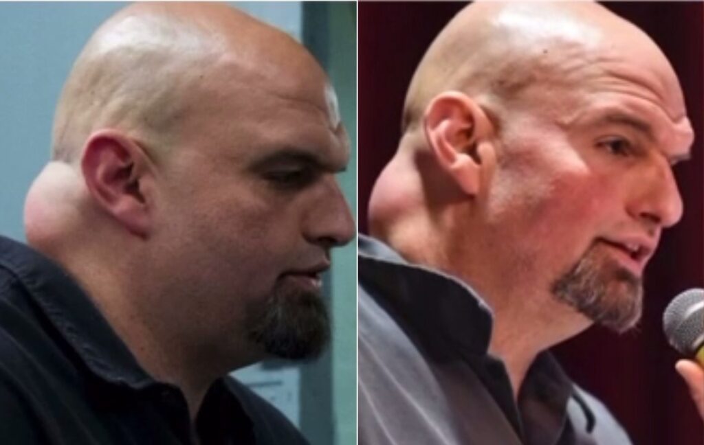 Fetterman Agrees to One Debate with Oz on October 25… with Certain Conditions