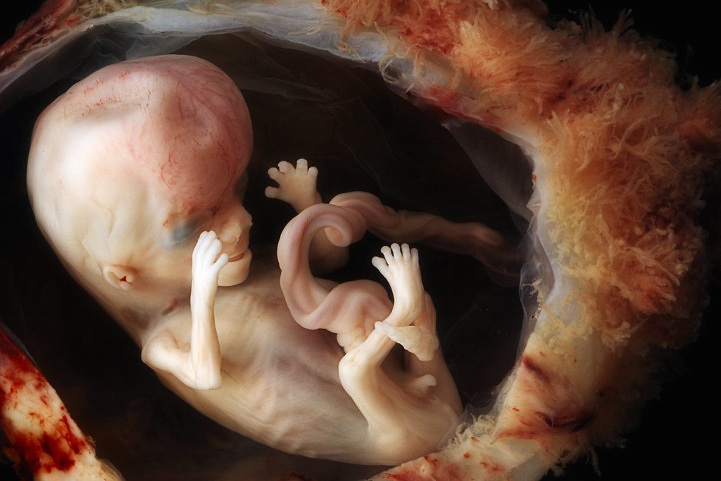 Newly-Opened Abortion Clinic Sets Weekly Quota For Number of Unborn Babies Killed