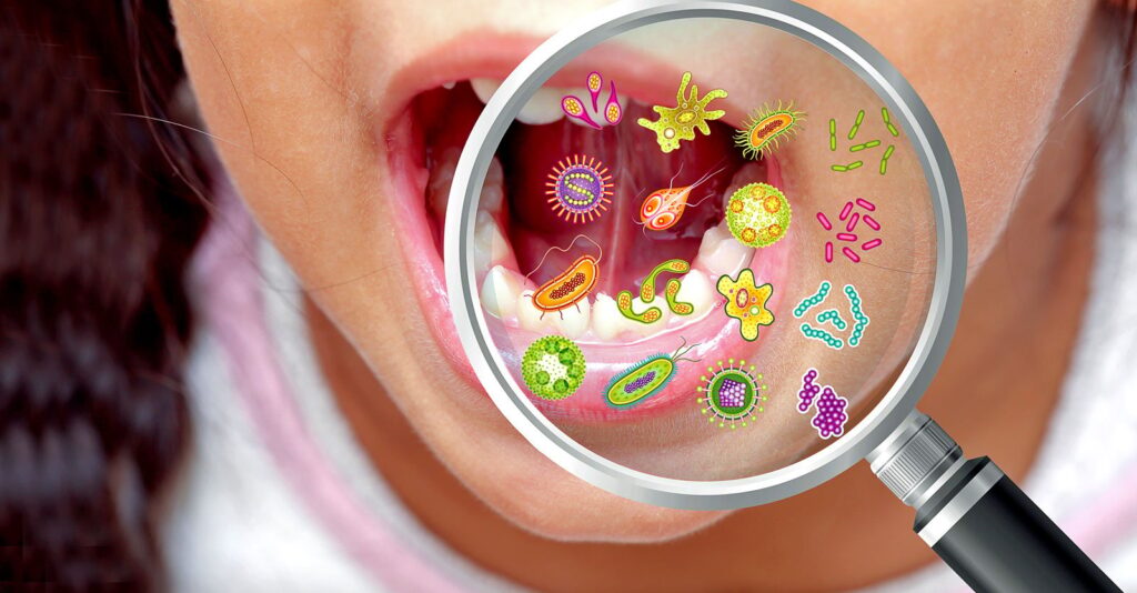 Study Sheds New Light on Kids, Tooth Decay and Bacteria ‘Teamwork’