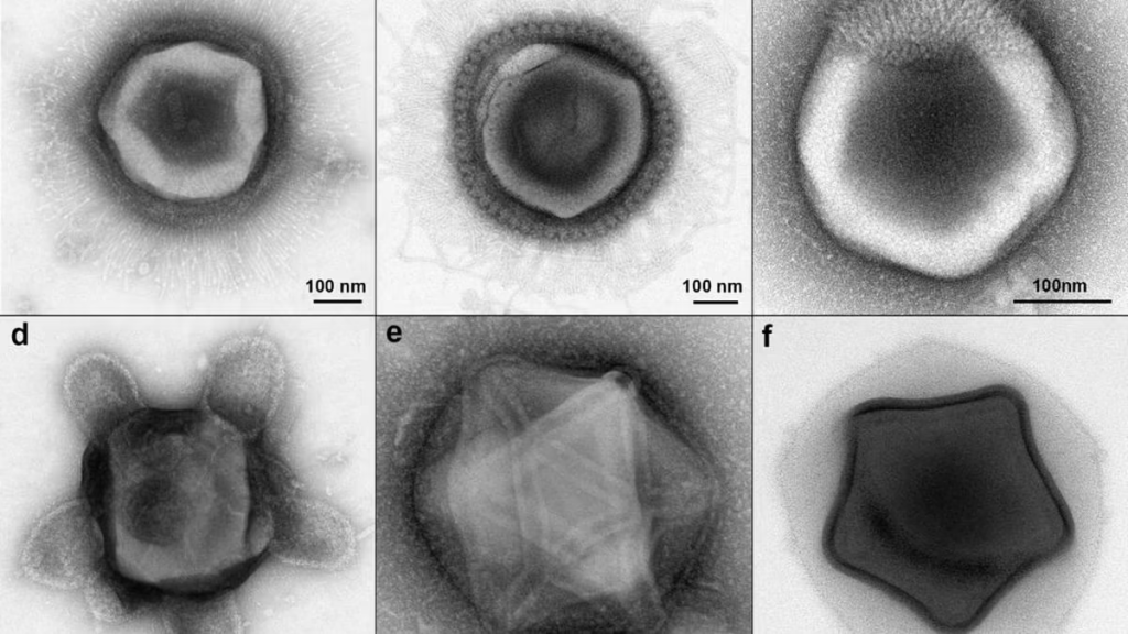 Rare alien-like viruses are discovered in New England soil that feature never before seen tentacles and star-like shapes