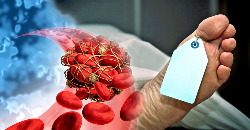 Exclusive: 70% of Embalmers Report Finding Strange Blood Clots Beginning in Mid-2021