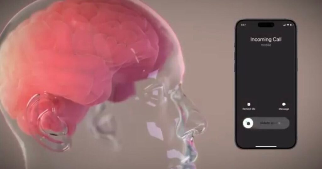 Neuralink First Human Patient Reportedly Makes ‘Full Recovery’, Musk Says Patient Can Control Computer Mouse With Thoughts
