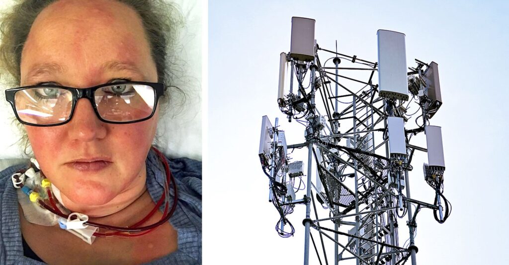 Exclusive: Woman Living Near Cell Tower Diagnosed With 51 Strokes