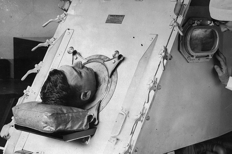 Paul Alexander, Man With Polio Forced Into Iron Lung In 1952, Passes Away At 78