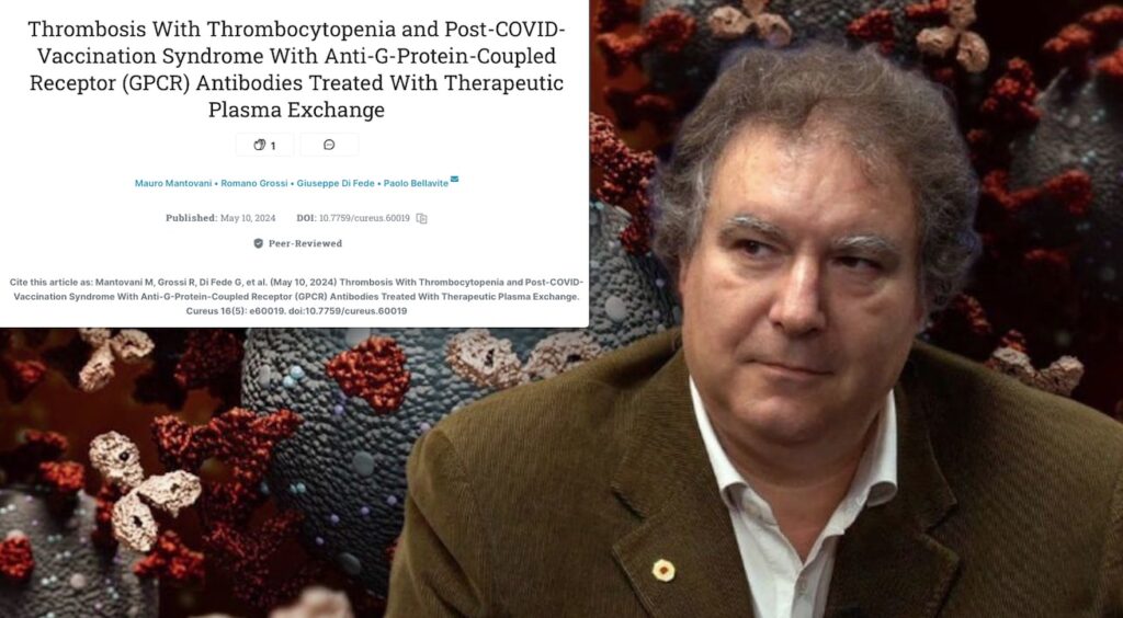 “Dangerous AutoAntibodies by Covid Vaccines”. Shocking Study on a Famous Californian Medical Journal