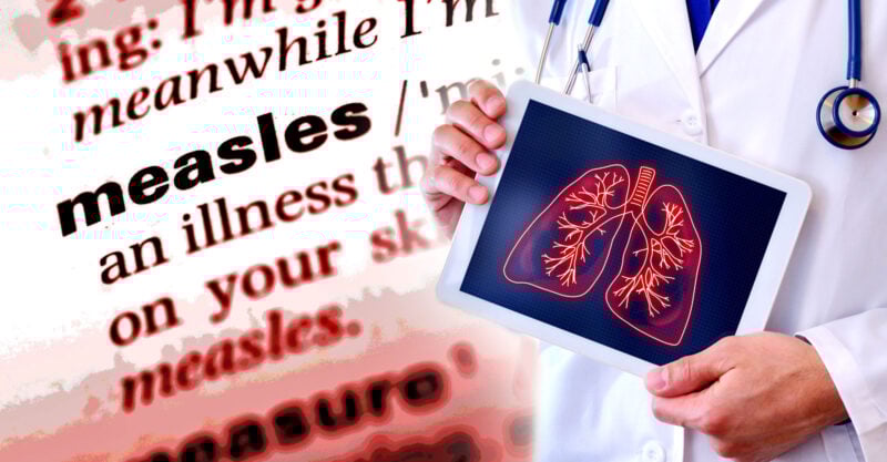 Texas Reports 8-Year-Old Died of ‘Measles Pulmonary Failure,’ CHD Requests Medical Records
