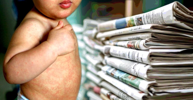 Media Reports of Vitamin A Toxicity in Kids Being Treated for Measles ‘Misleading,’ Doctor Says