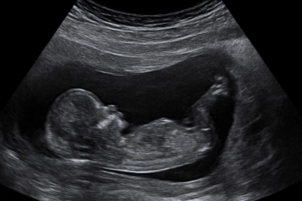 Texas Busts Illegal Abortion Ring; Discovers Foreigners Doing The Procedure